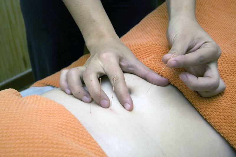 osteopathe-TRIGANCE-min_acupuncture-4175625